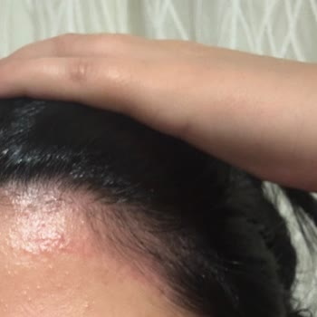 Gebelikte Güvenli Denilen Boya Kabusu