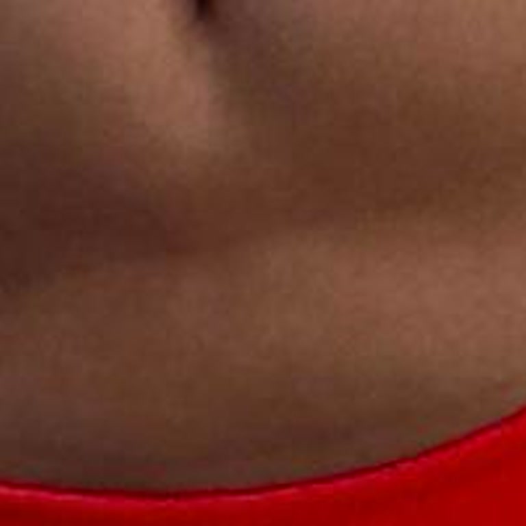 Ameliyat Sonrası Kalıcı İzler Ve İlgisizlik