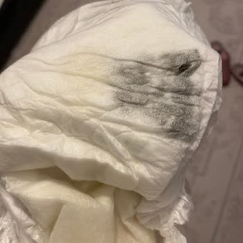 Bebek Bezinde Şaşırtan Siyahlık Ve Sertlik