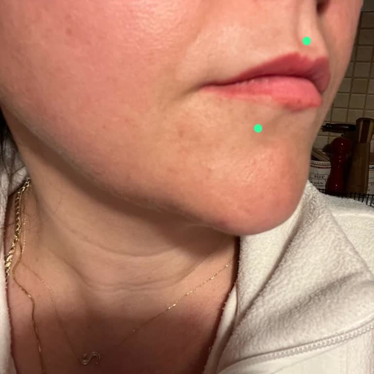 Profesyonellikten Uzak Salon Deneyimi: Yamuk Dudaklar Ve İade Sorunu