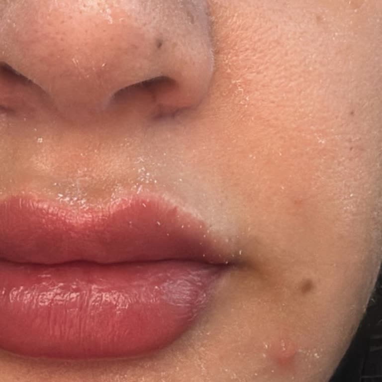 Yves Rocher Kremi Ciltte Pul Pul Dökülme Yapıyor!