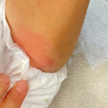 Sleepy Bebek Bezi: Kalite Sorunu Ve Müşteri Hizmetleri Hayal Kırıklığı