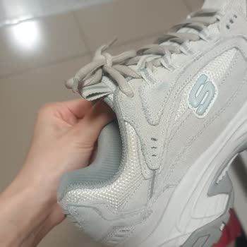 Skechers Ayakkabıda Beklenmedik Renk Solması Ve Yırtılma Sorunu