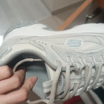 Skechers Ayakkabıda Beklenmedik Renk Solması Ve Yırtılma Sorunu