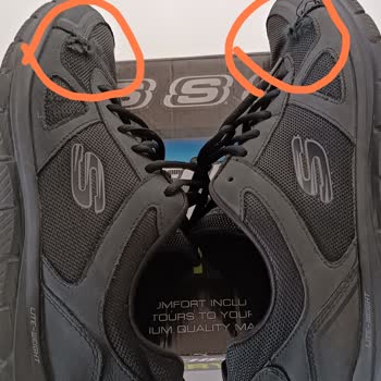 A101'den Aldığım Skechers Ayakkabı 6 Ayda Dağıldı: Müşteri Hizmetleri Ve Garanti Sorunları