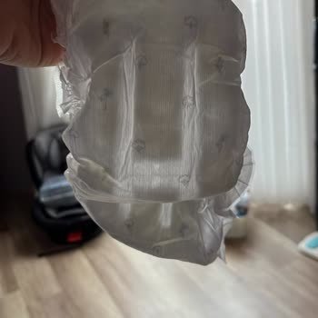 Defolu Bebek Bezleri Ve Sızıntı Problemi