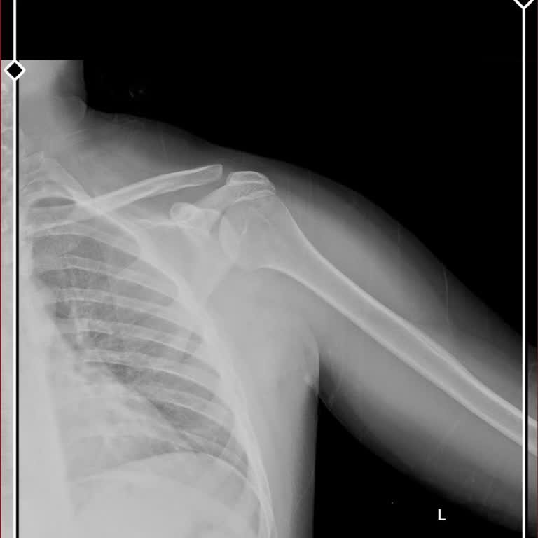 Fiyuu İş Kazası Sonrası Destek Alamama Sorunu