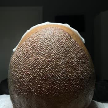 Transfer Hizmetinde Yaşanan Gecikme Ve Müşteri Memnuniyetsizliği