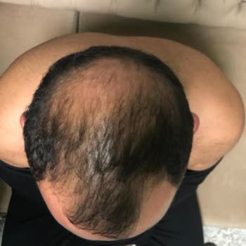 Transfer Hizmetinde Yaşanan Gecikme Ve Müşteri Memnuniyetsizliği