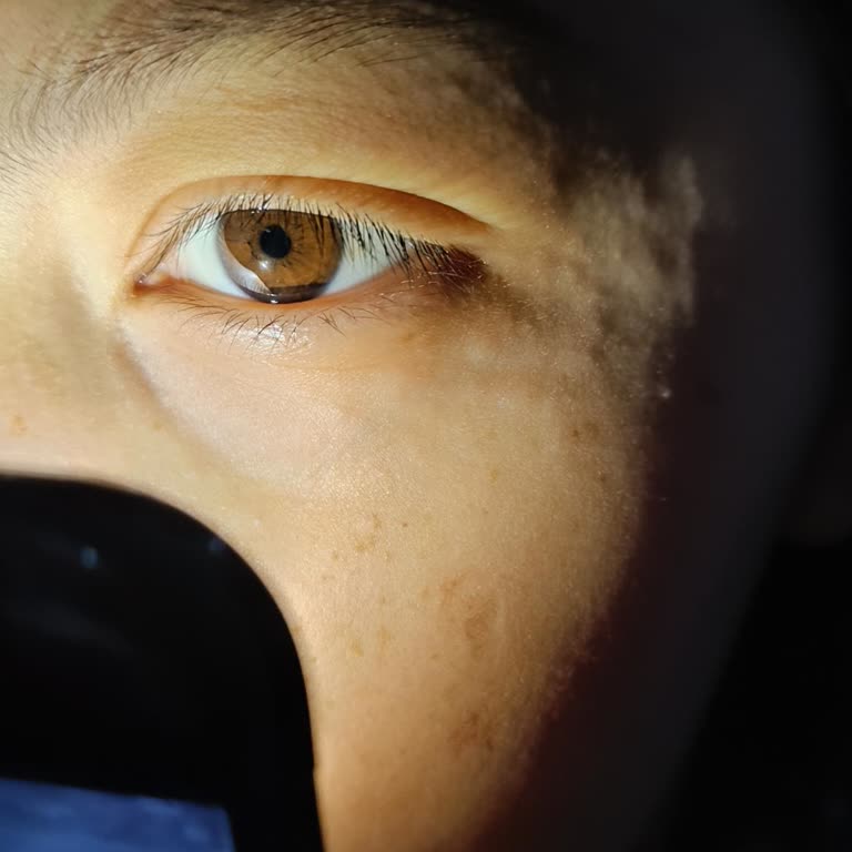 Gesaş Vişne Reçeli Yüzümde Alerji Yaptı