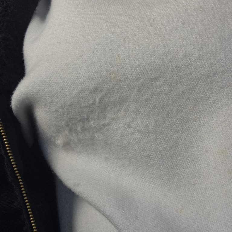 Müşteri Memnuniyeti Sıfır: Tüylenen Kazak Sorunu