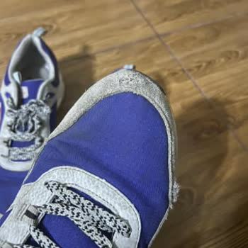 Skechers Ayakkabılarında Kalite Sorunu Ve Müşteri Hizmetleri Hayal Kırıklığı