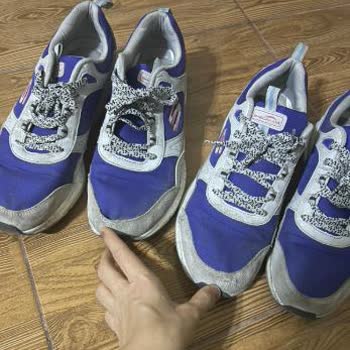 Skechers Ayakkabılarında Kalite Sorunu Ve Müşteri Hizmetleri Hayal Kırıklığı