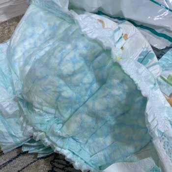 Prima Bebek Bezlerinde Kalıntı Sorunu