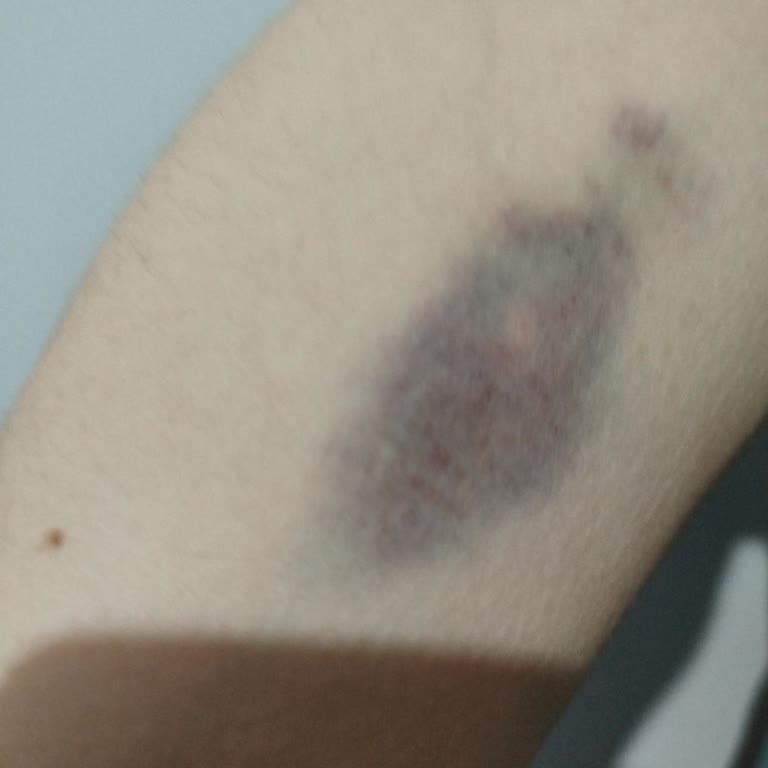 Acil Servisteki Kan Alma Deneyimi