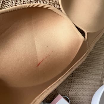 Kampanyalı Ürünlerde Hijyen Sorunu Ve İletişimsizlik