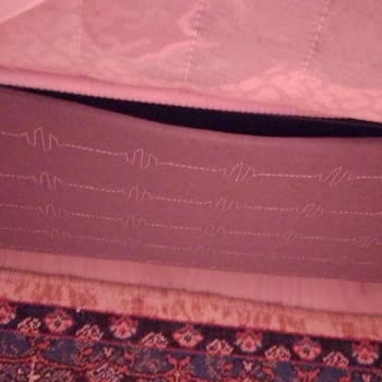 Hasarlı Baza Ve İletişim Eksikliği