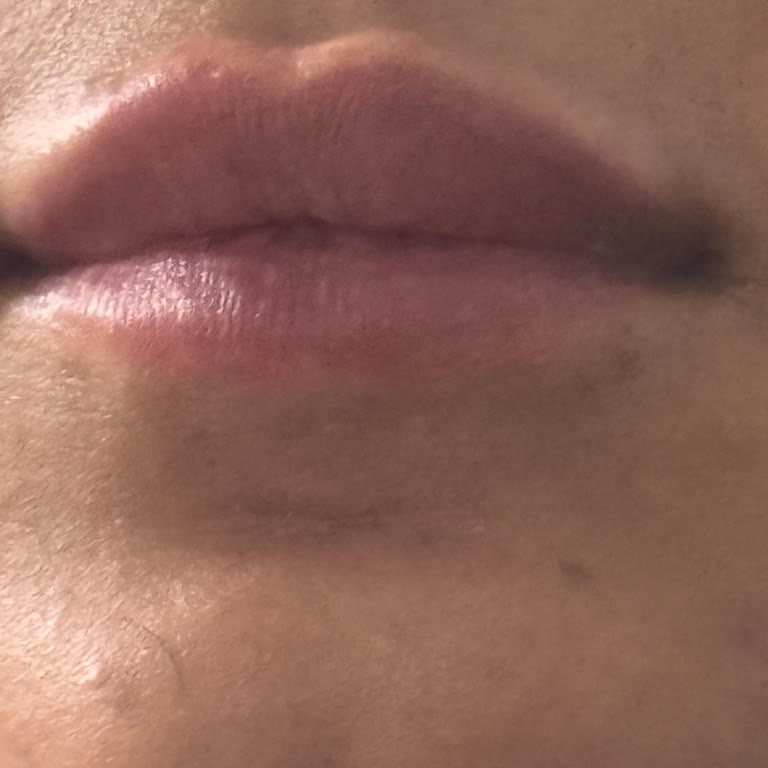 Kosmetolog_lalita Hijyenik Olmayan Ortamda Yetersiz Hizmet