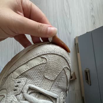 Skechers Ayakkabıda Kalite Sorunu Ve Müşteri Hizmetleri Erişimsizliği