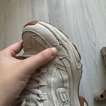 Skechers Ayakkabıda Kalite Sorunu Ve Müşteri Hizmetleri Erişimsizliği