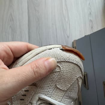 Skechers Ayakkabıda Kalite Sorunu Ve Müşteri Hizmetleri Erişimsizliği