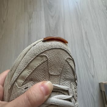 Skechers Ayakkabıda Kalite Sorunu Ve Müşteri Hizmetleri Erişimsizliği