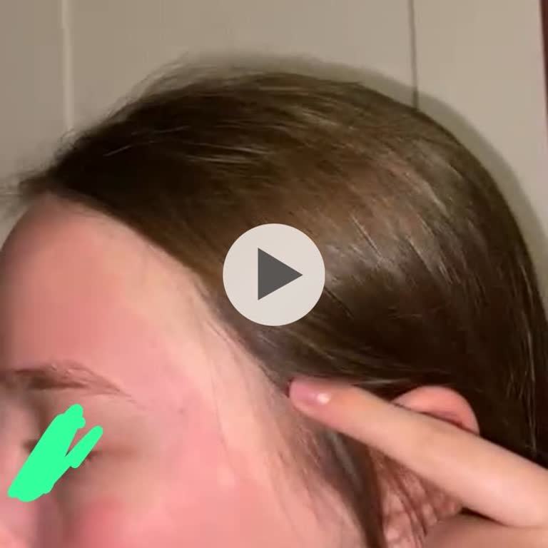 Kil Maskesi Alerjik Reaksiyon Yarattı