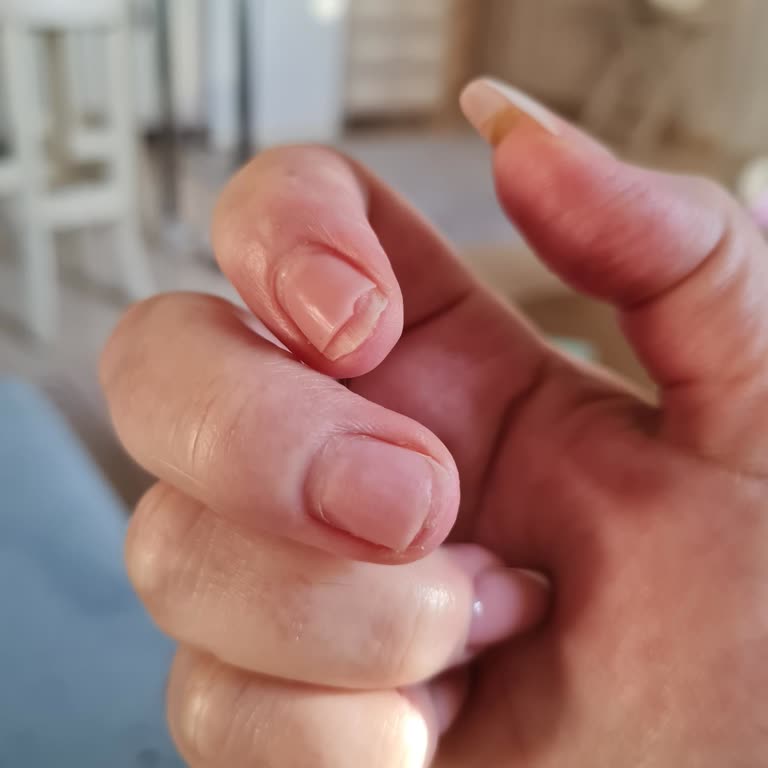 Bodrum'da Kötü Protez Tırnak Deneyimi