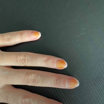 Flormar Oje Tırnakta Kalıcı Turunculuk Bırakıyor