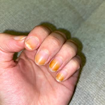 Flormar Oje Tırnakta Kalıcı Turunculuk Bırakıyor