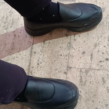 Skechers Ayakkabıda Çökme Sorunu Ve Müşteri Hizmetleri Hayal Kırıklığı