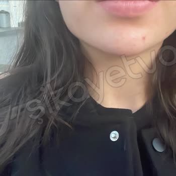 Kosmetolog_lalita Dolgu Hizmetinde Hayal Kırıklığı!