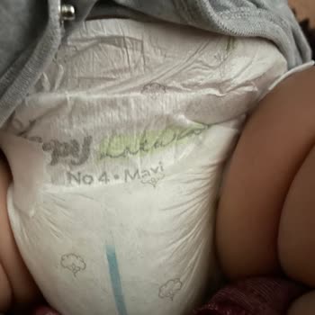 Sleepy Ve Molfix Bebek Bezlerinde Sızdırma Sorunu