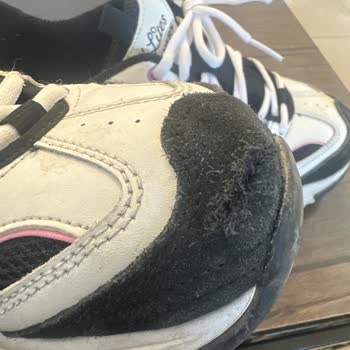 Skechers Ayakkabıda Kalite Sorunu Ve İade Problemi