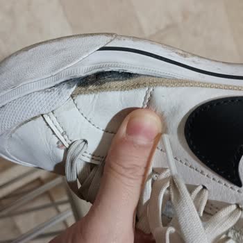 Deichmann Ayakkabısında Tekrarlayan Açılma Sorunu