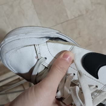 Deichmann Ayakkabısında Tekrarlayan Açılma Sorunu