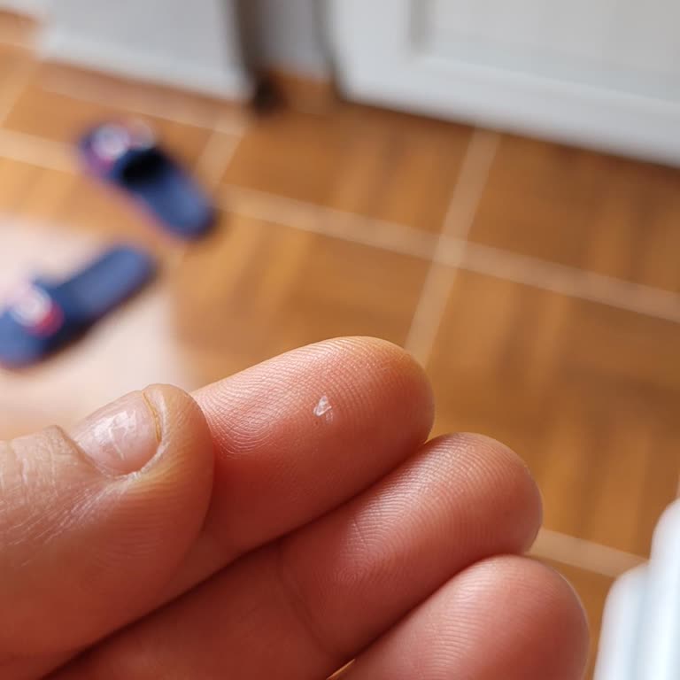 Kahve Yanında Gelen Tehlikeli Sürpriz