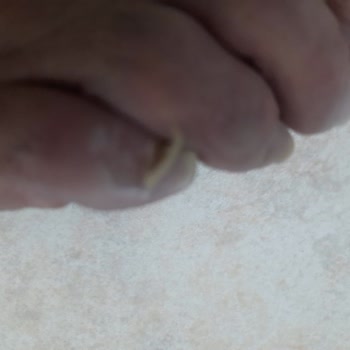 Aldığım Ayakkabılar Ayaklarımı Mahvetti