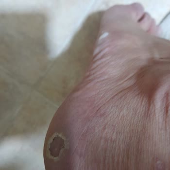 Aldığım Ayakkabılar Ayaklarımı Mahvetti