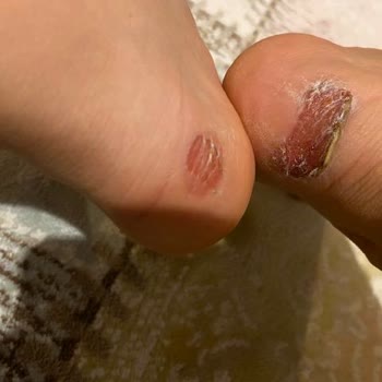 Ayağımı Yaralayan Bot Ve İlgisiz Müşteri Hizmetleri