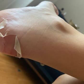 Ayağımı Yaralayan Bot Ve İlgisiz Müşteri Hizmetleri