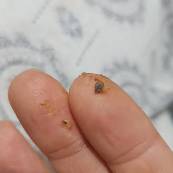 Humm Kekinde Taş Şoku