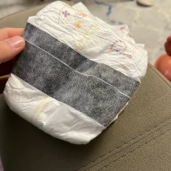 Defolu Bebek Bezi Mağduriyeti