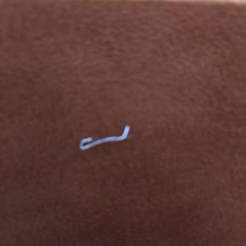 Pastadan Çıkan Zımba Teli Tehlikesi