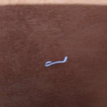 Pastadan Çıkan Zımba Teli Tehlikesi