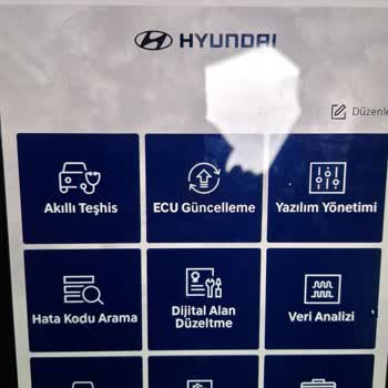Hyundai Servisinde Gizli Beyin Değişimi Skandalı