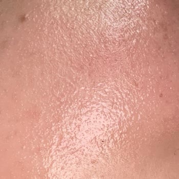 Clinique Nemlendirici Yanık Etkisi Yarattı