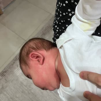 Bebeğimize Alerji Yapan Mama Kabusu