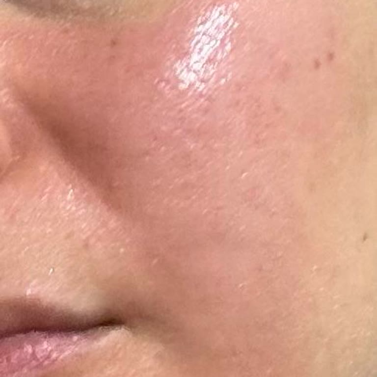 Bioderma Leke Açıcı Serum Yüzümü Yaktı