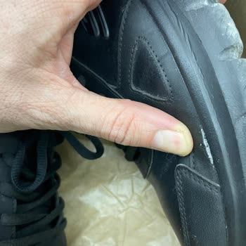 Garanti İhlali Ve Müşteri Hizmetleri Sorunu